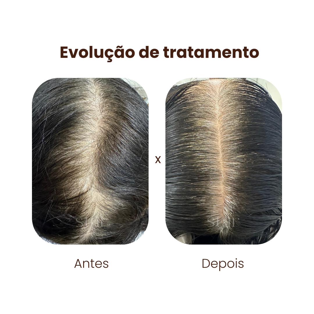 antes e depois (2)