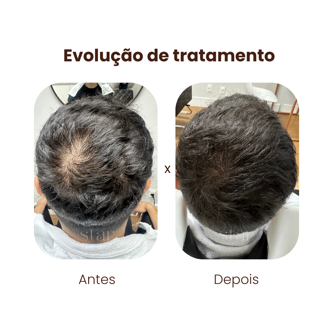 antes e depois (3)