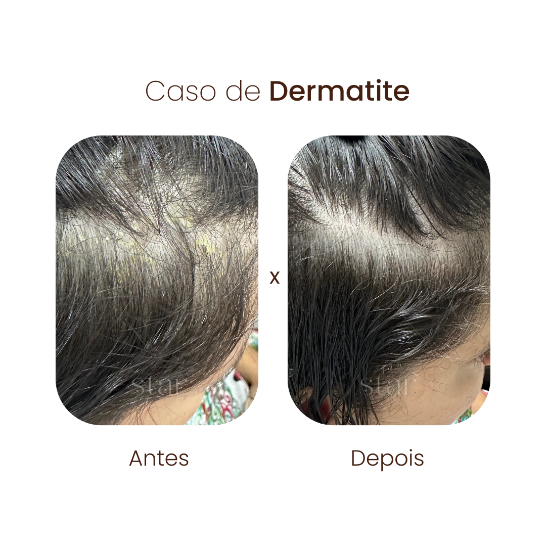 antes e depois (4)