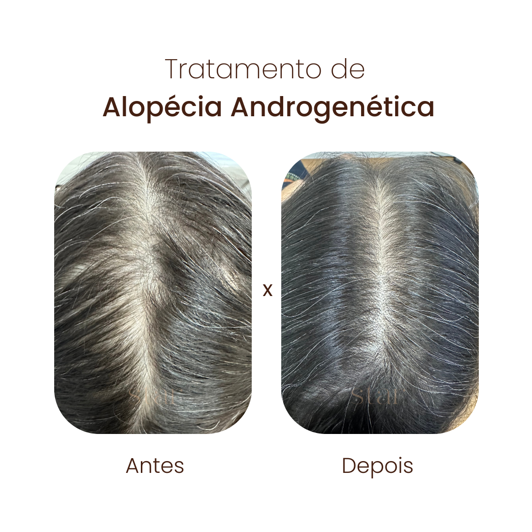 antes e depois (5)