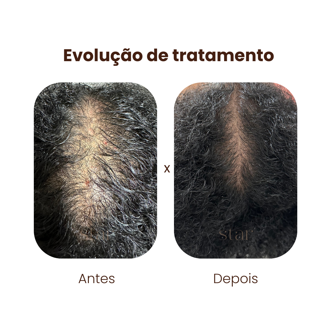 antes e depois (6)