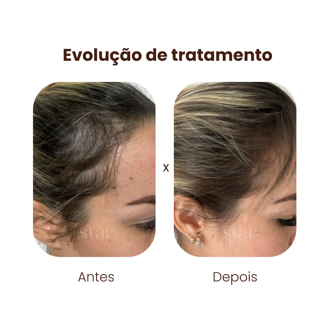 antes e depois (7)