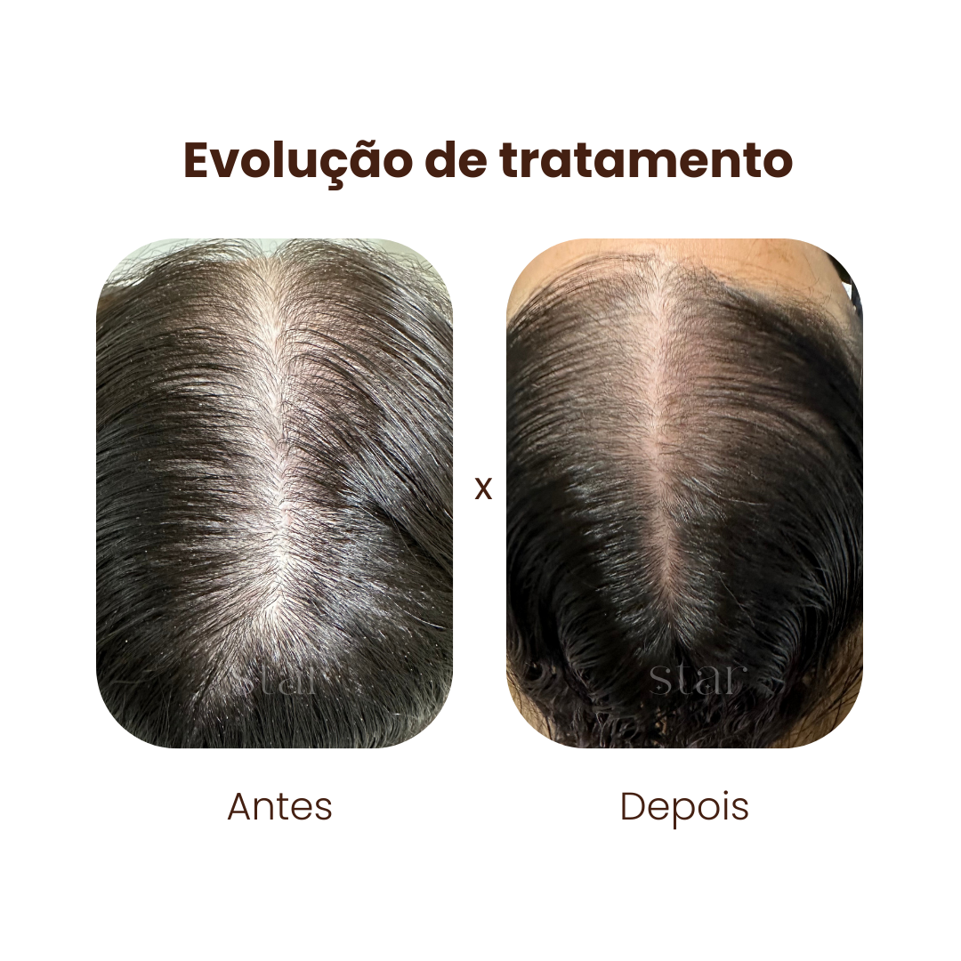 antes e depois (8)