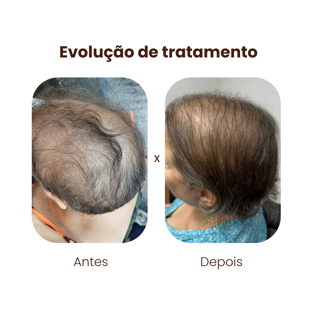 antes e depois (9)